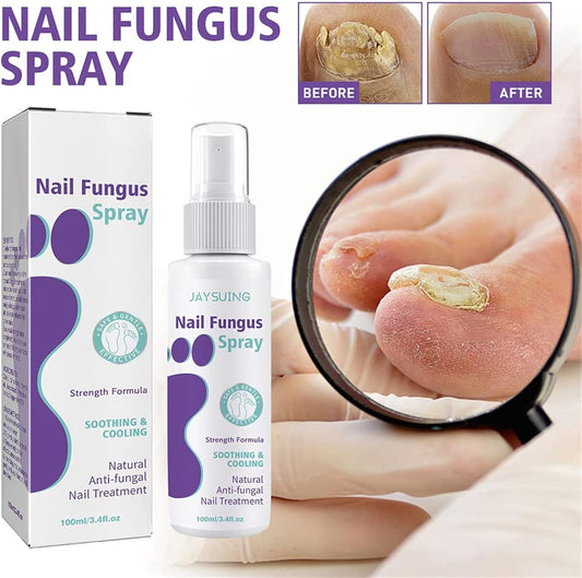 Nail Fungus Spray,Fungal Nail Treatment For Toenails Extra Strong